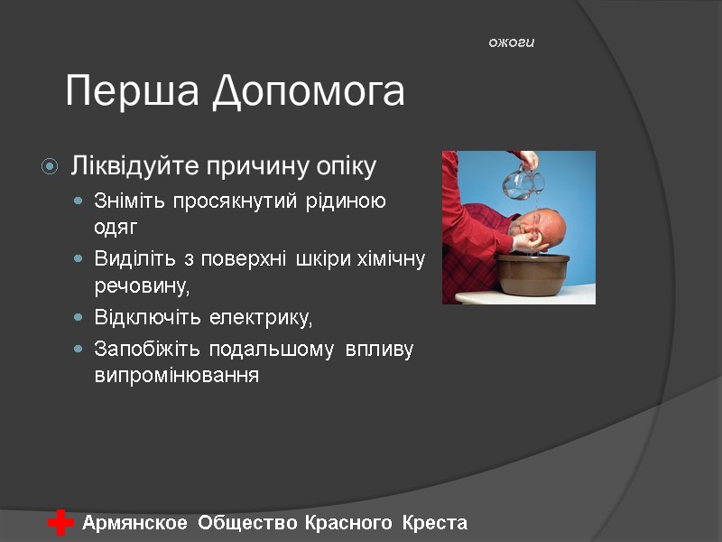 Перша Допомога Ліквідуйте причину опіку Зніміть просякнутий рідиною одяг Виділіть з поверхні шкіри хімічну
